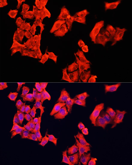 Anti-BRAF Antibody (CAB15033)