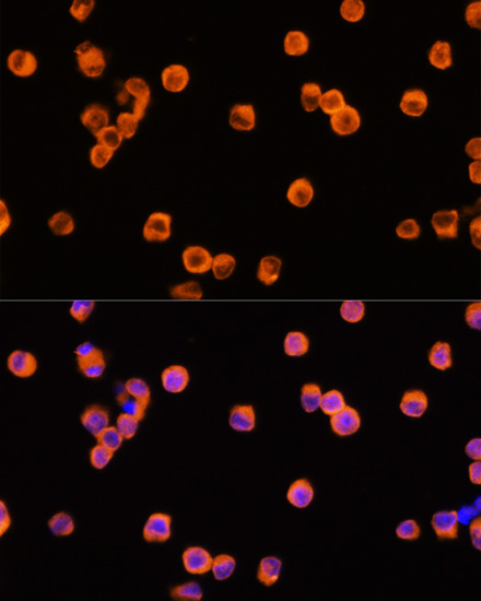 Anti-NLRP3 Antibody (CAB12694)