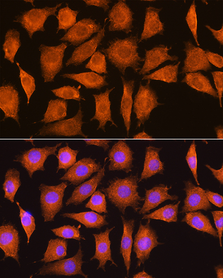 Anti-NCSTN Antibody (CAB14505)