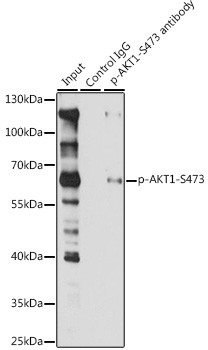 Anti-Phospho-AKT1-S473 Antibody (CABP0098)