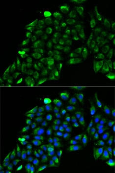 Anti-ACADS Antibody (CAB7230)