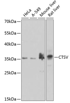 Anti-CTSV Antibody (CAB7662)