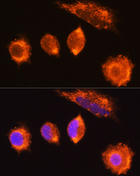 Anti-MGAT1 Antibody (CAB6387)