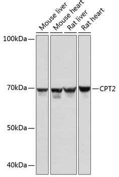 Anti-CPT2 Antibody