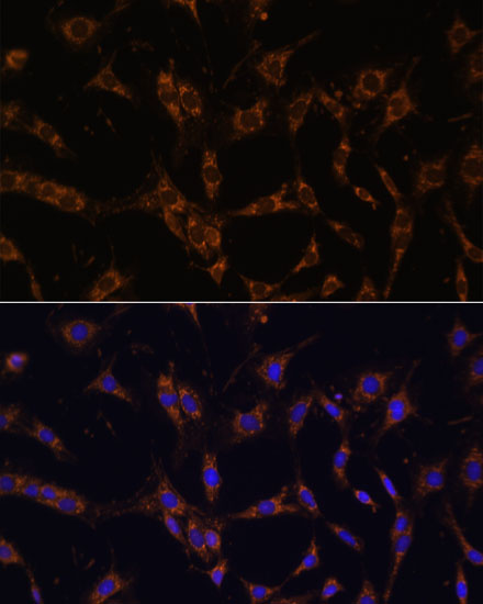 Anti-UBE2J1 Antibody (CAB15841)