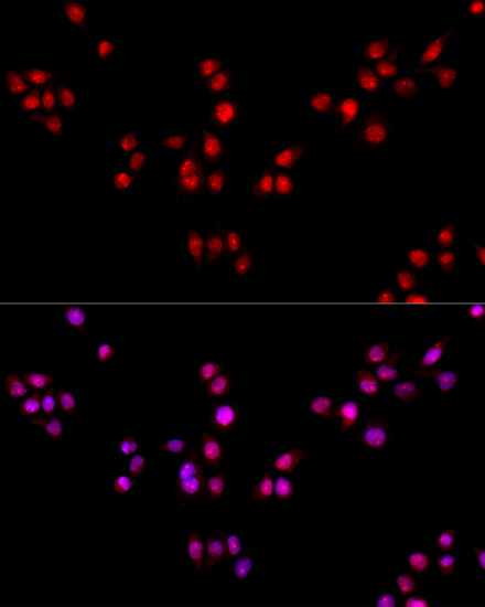 Anti-ESRRA Antibody (CAB14184)