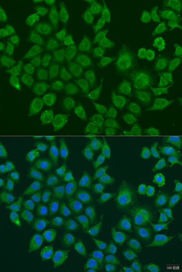 Anti-BLOC1S2 Polyclonal Antibody (CAB8007)