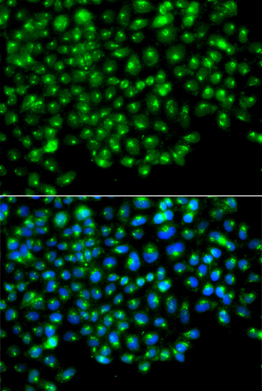 Anti-GOPC Antibody (CAB13436)