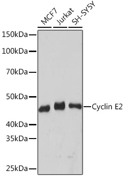 Anti-Cyclin E2 Antibody (CAB9305)