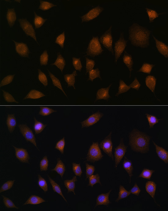 Anti-Sorting nexin-1 Polyclonal Antibody (CAB8625)