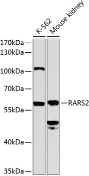 Anti-RARS2 Polyclonal Antibody (CAB8503)