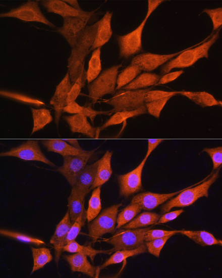 Anti-AIRE Antibody (CAB1767)