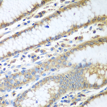 Anti-PDIA3 Antibody (CAB1085)