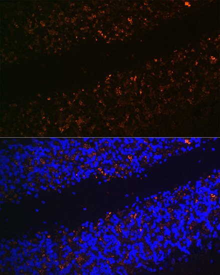 Anti-SLC17A6 Antibody (CAB15177)