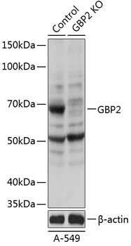 Anti-GBP2 Antibody [KO Validated] (CAB19874)