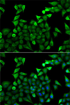 Anti-TPSAB1 Antibody (CAB2022)