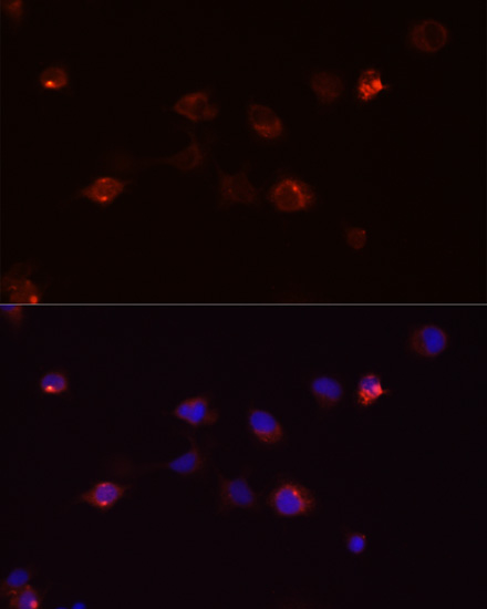 Anti-DEFB4A Antibody (CAB1643)