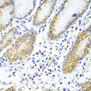 Anti-ATAD3A Polyclonal Antibody (CAB8230)