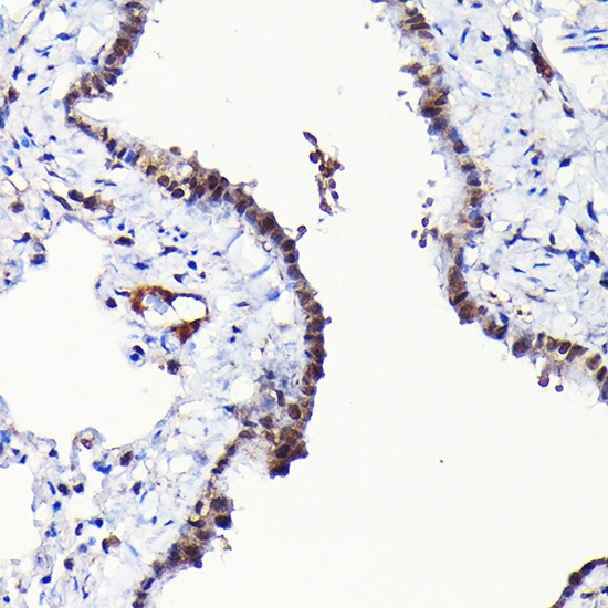 Anti-RGS14 Polyclonal Antibody (CAB9962)