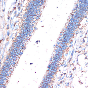 Anti-CD44 Antibody (CAB0340)