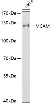 Anti-MCAM Antibody (CAB1962)