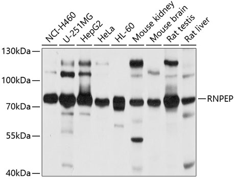 Anti-RNPEP Antibody (CAB4080)