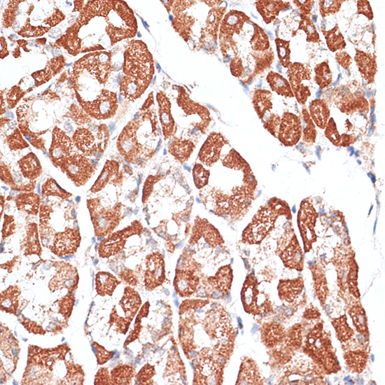 Anti-KIF2C Antibody (CAB5449)