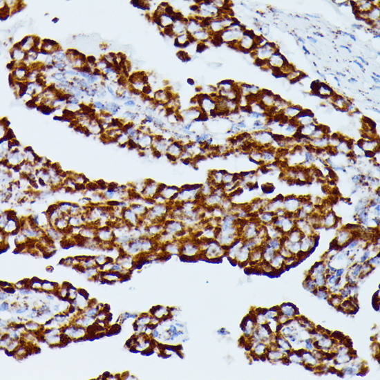 Anti-IDH3A Antibody (CAB14650)