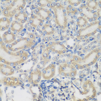 Anti-PYCR1 Antibody (CAB13346)