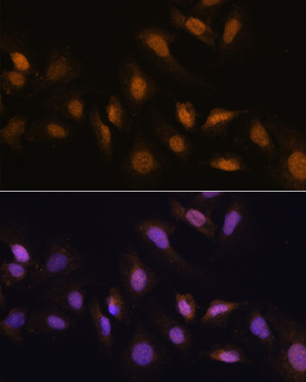 Anti-RBM39 Antibody (CAB15760)