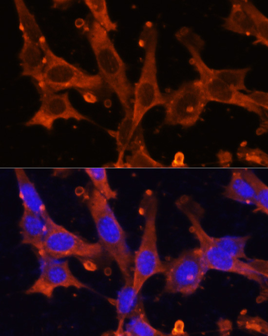 Anti-GAPDH Antibody (High Dilution) (CABC033)