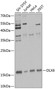 Anti-DLX6 Antibody (CAB7667)