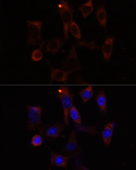 Anti-YTHDC2 Antibody (CAB15004)