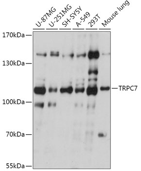 Anti-TRPC7 Antibody (CAB17738)