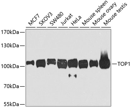 Anti-TOP1 Antibody (CAB7741)