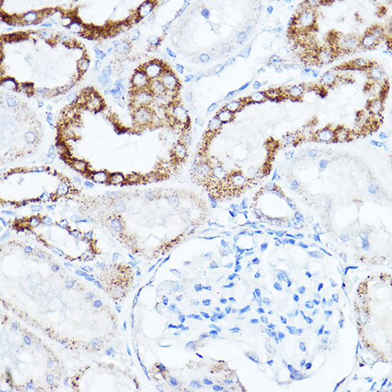 Anti-LDLR Antibody (CAB14996)