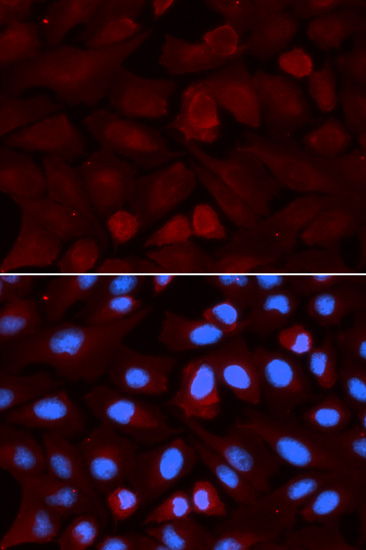 Anti-ALDH3A1 Antibody (CAB5502)