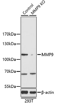 Anti-MMP9 Antibody [KO Validated] (CAB2095)