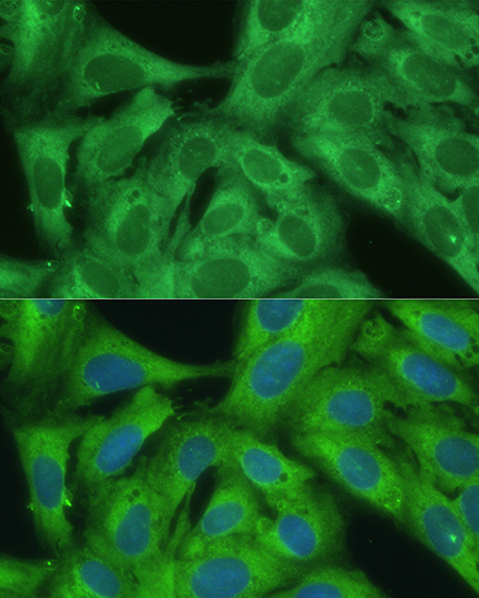 Anti-NF-kB p65 Antibody (CAB2547)