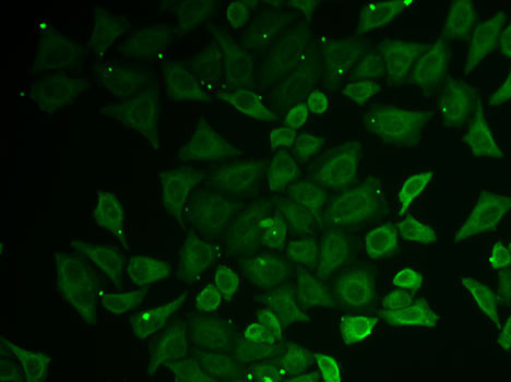 Anti-C21orf33 Antibody (CAB6429)