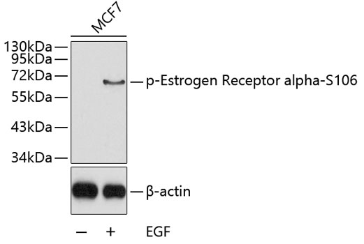 Anti-Phospho-Estrogen receptor-S106 Antibody (CABP0347)