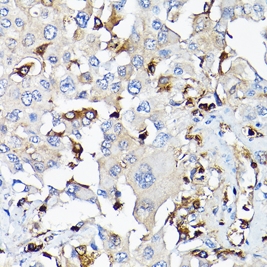 Anti-IGF1 Antibody (CAB0303)