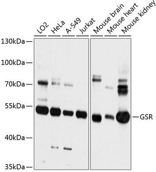 Anti-GSR Antibody (CAB12070)