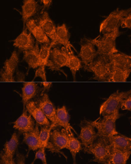 Anti-SNX15 Polyclonal Antibody (CAB9158)