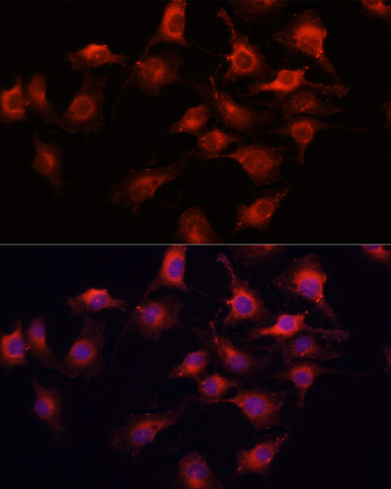 Anti-VEGFA Antibody (CAB0280)