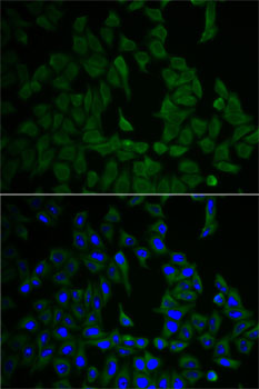 Anti-NF2 Antibody (CAB2456)