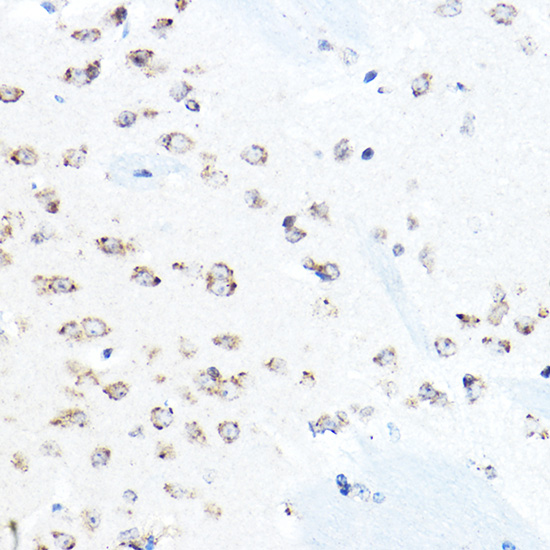 Anti-HSP90B1 Antibody (CAB6272)