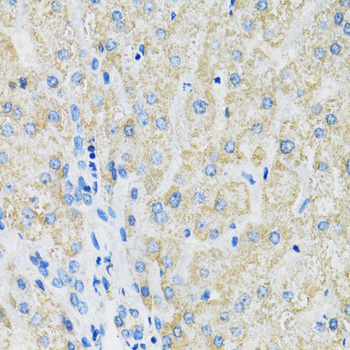 Anti-SLC19A1 Antibody (CAB14644)