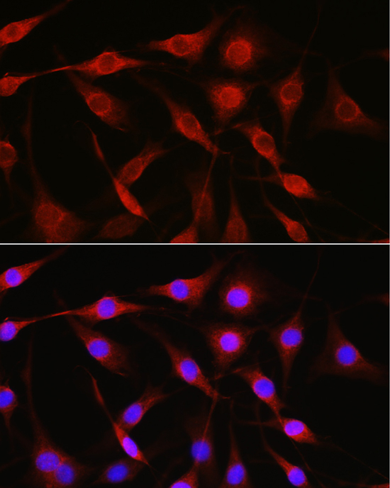 Anti-LAMP1 Antibody (CAB16895)