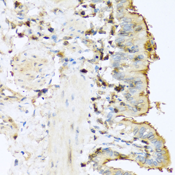 Anti-PRSS1 Antibody (CAB1242)